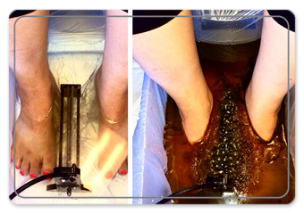 ion-foot-spa-before-and-after